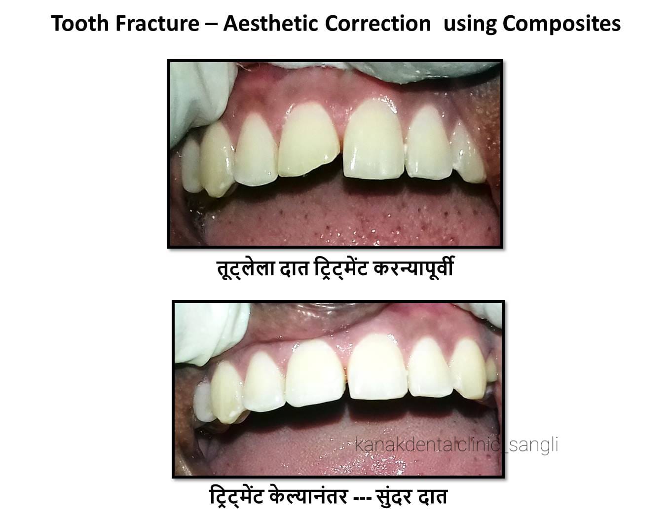 Kanak Dental Clinic gallery