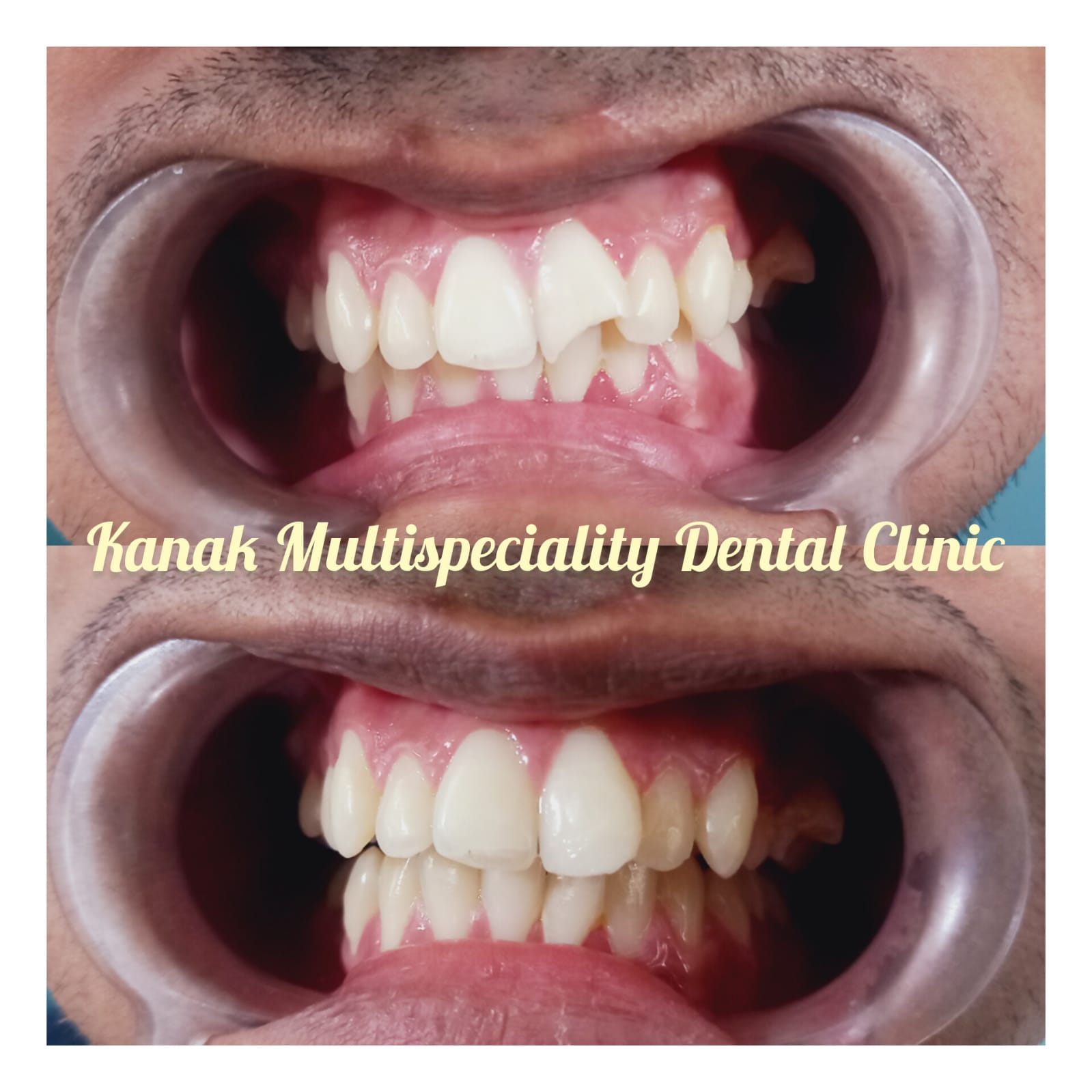 Kanak Dental Clinic gallery