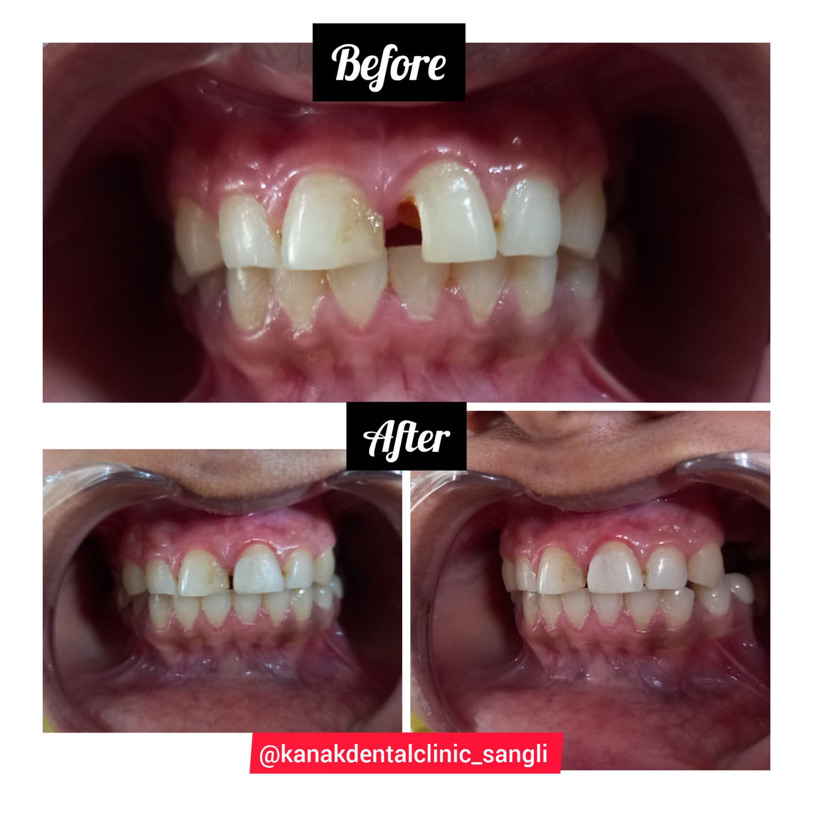 Kanak Dental Clinic gallery