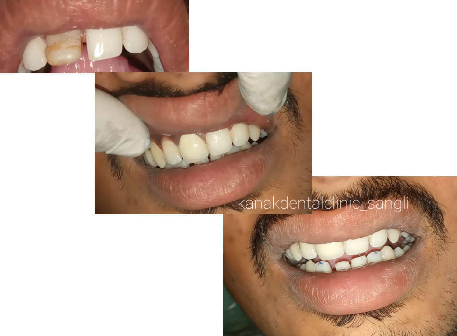Kanak Dental Clinic gallery