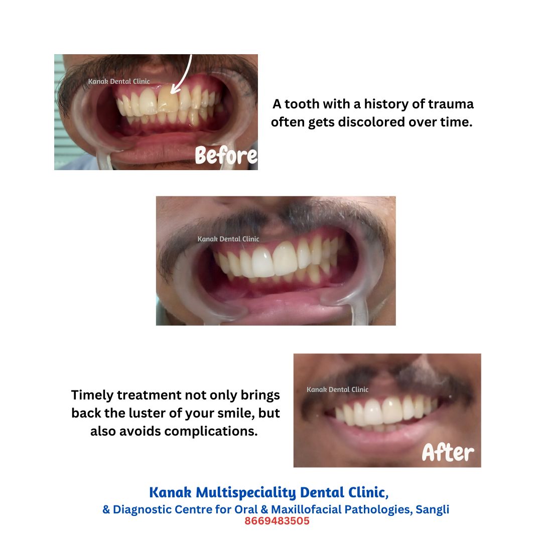 Kanak Dental Clinic gallery