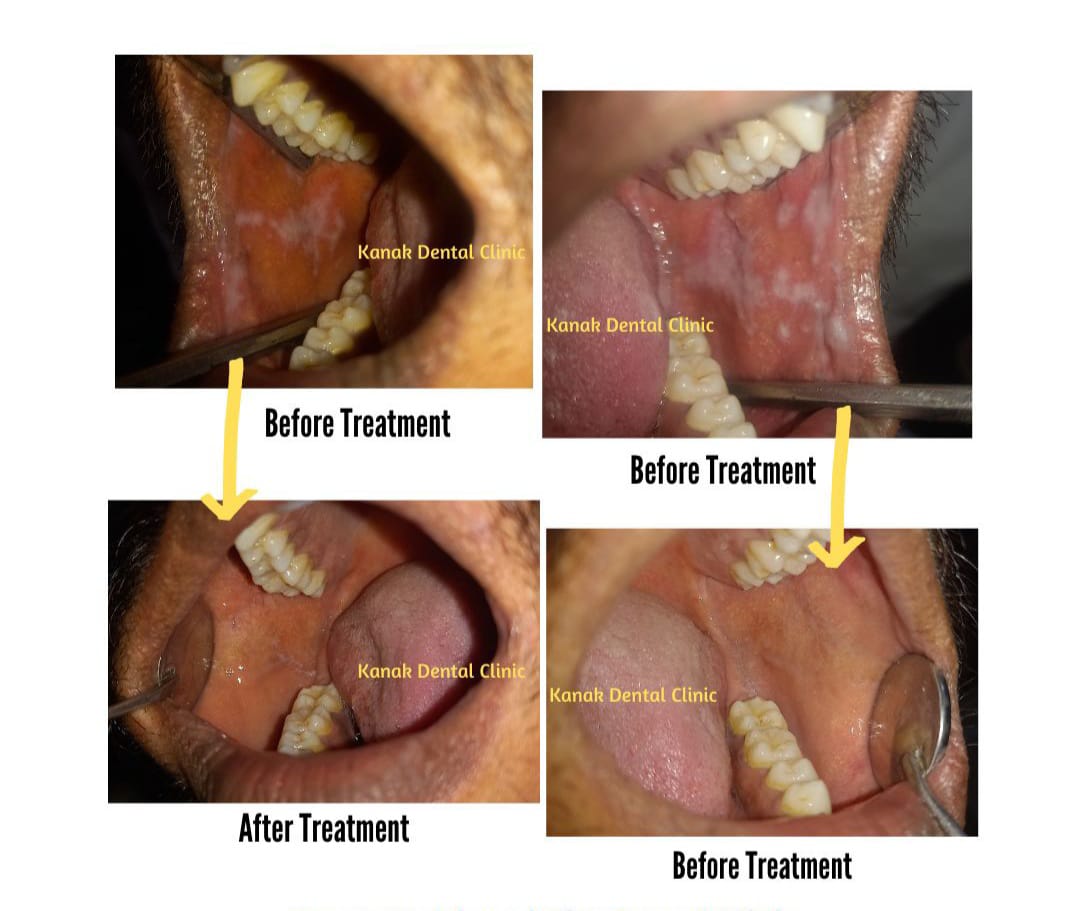 Kanak Dental Clinic gallery