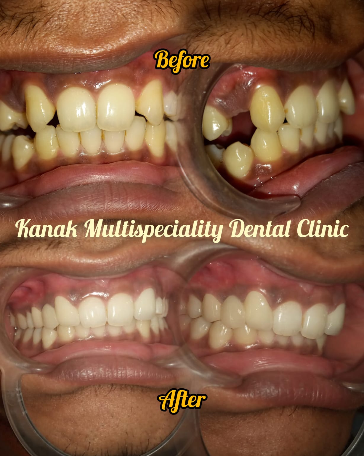 Kanak Dental Clinic gallery