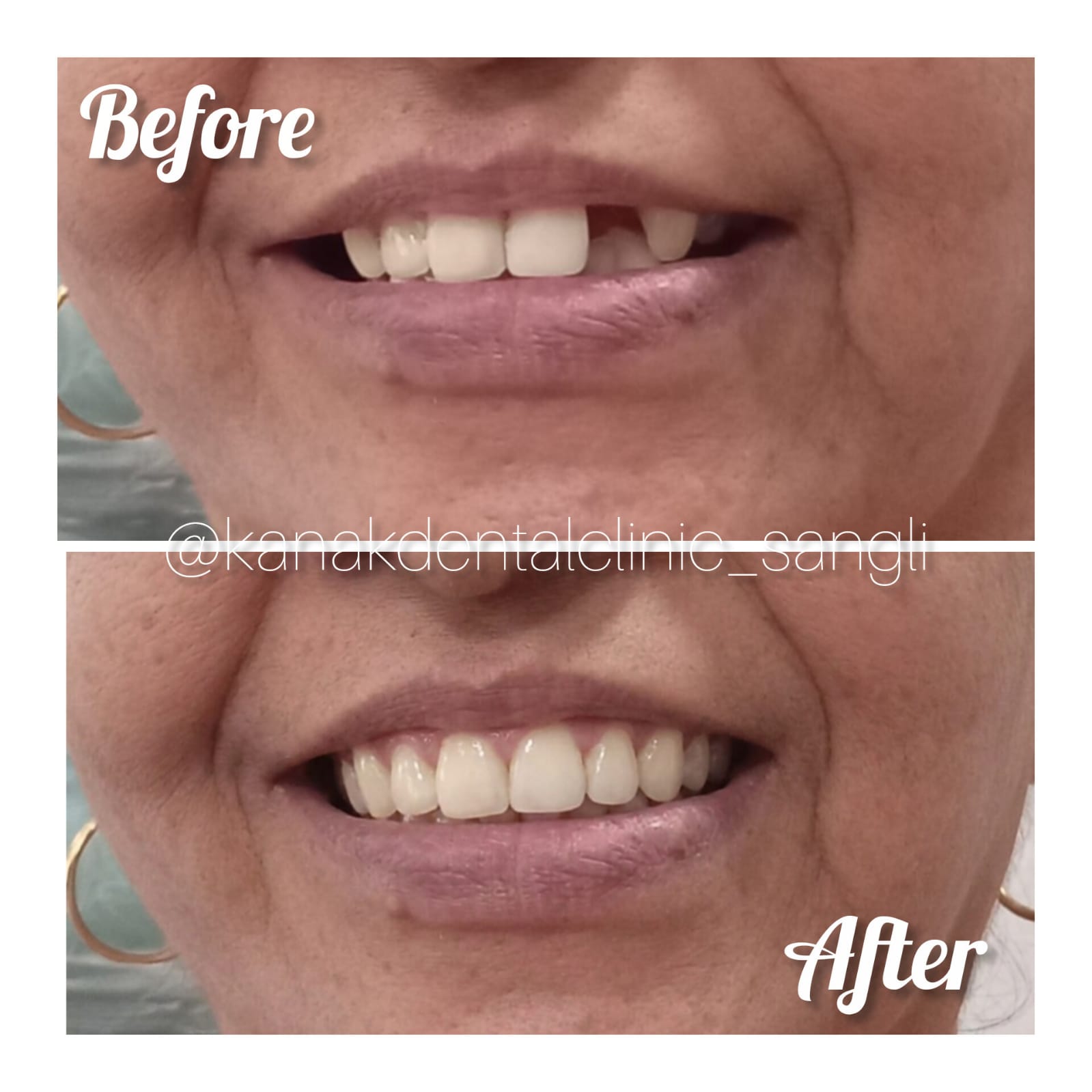 Kanak Dental Clinic gallery