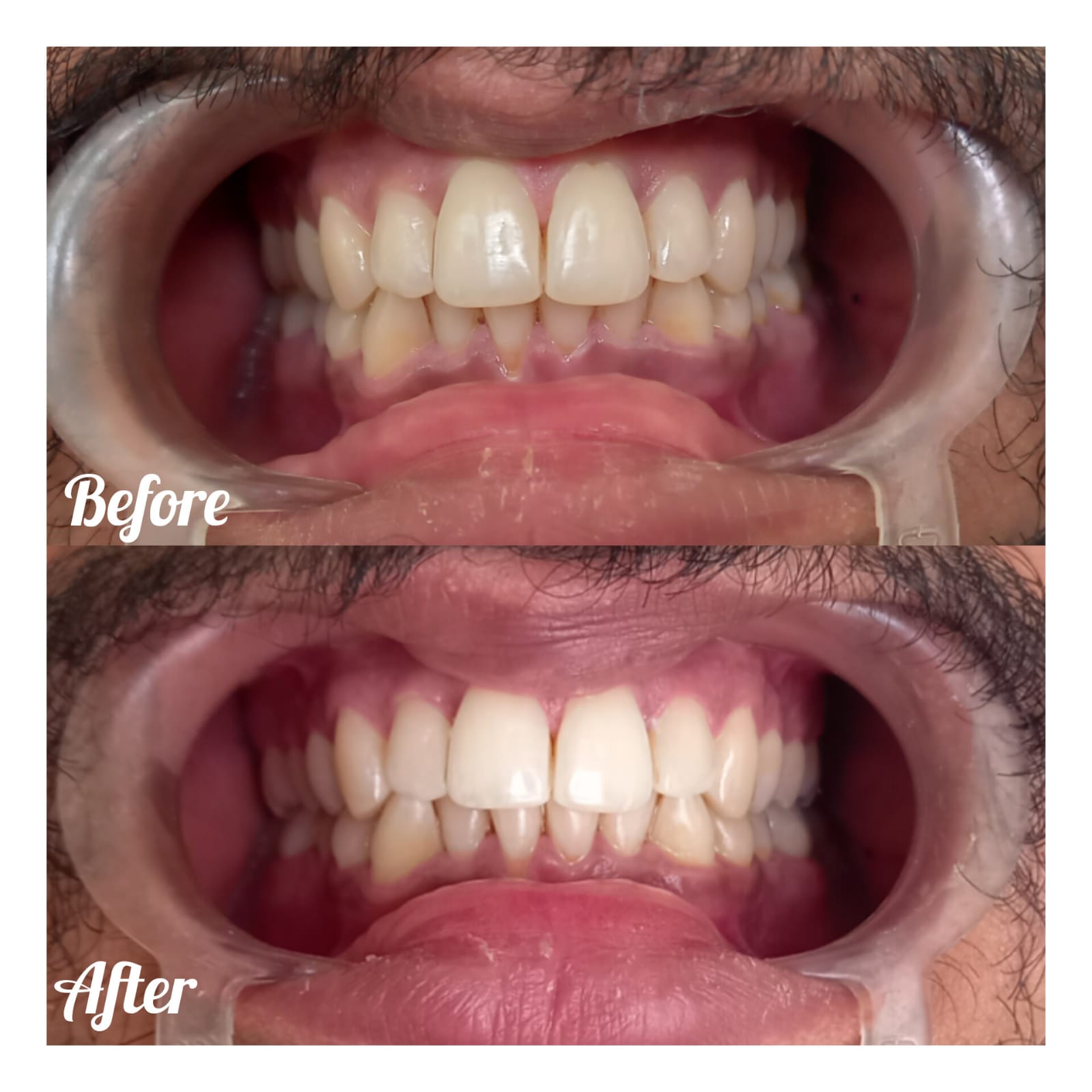 Kanak Dental Clinic gallery