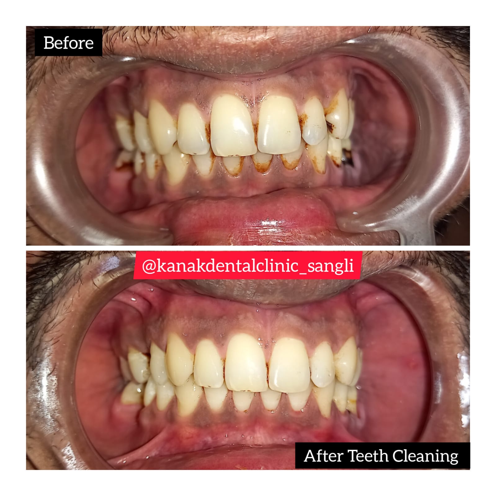 Kanak Dental Clinic gallery