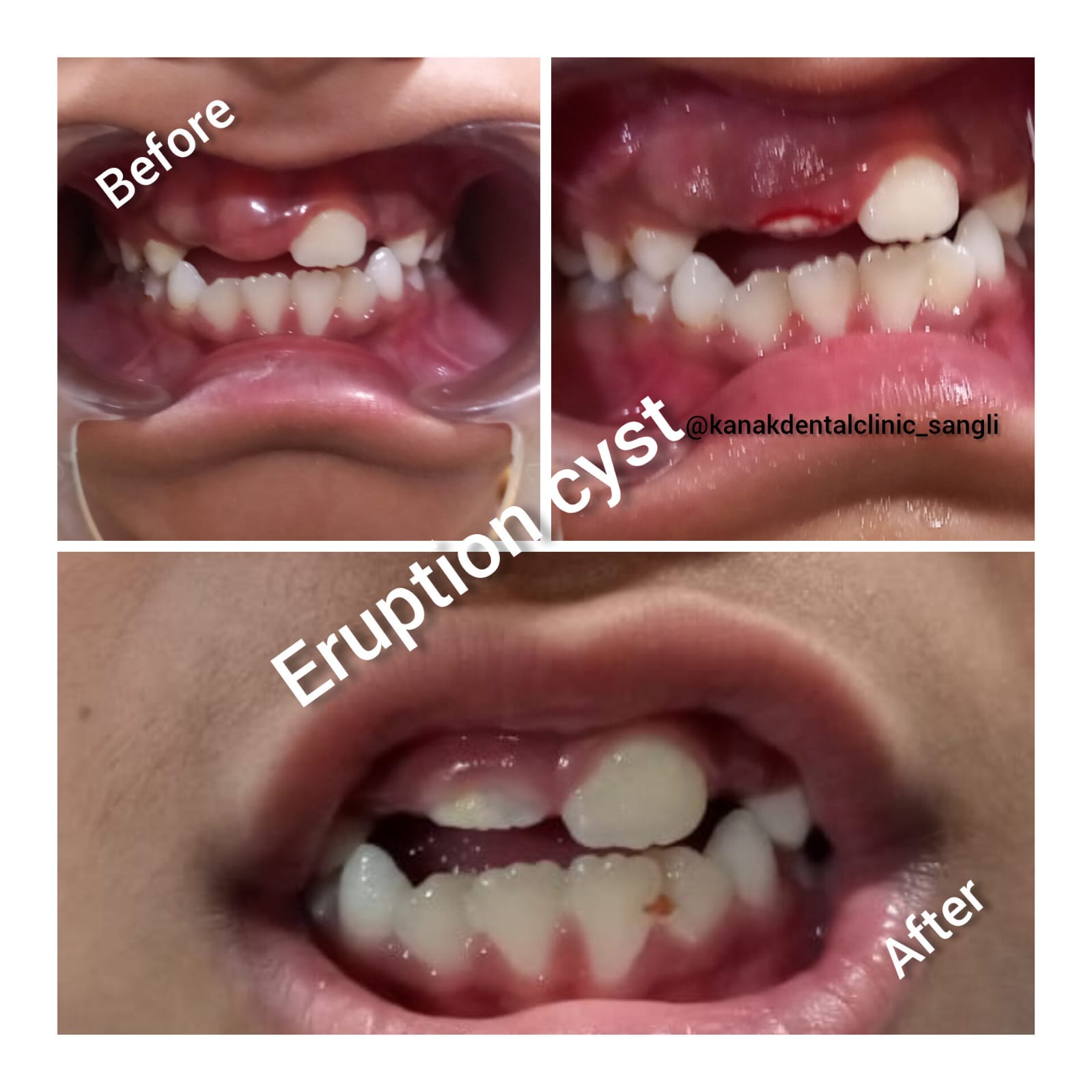 Kanak Dental Clinic gallery