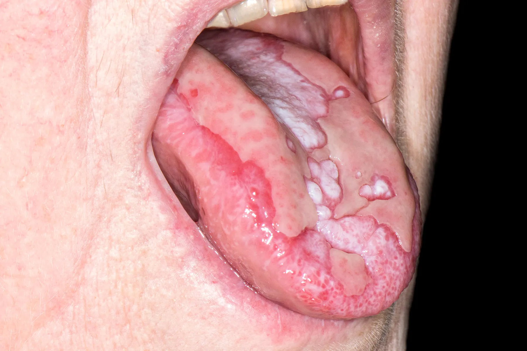 Diagnosis and Treatment of Oral Diseases